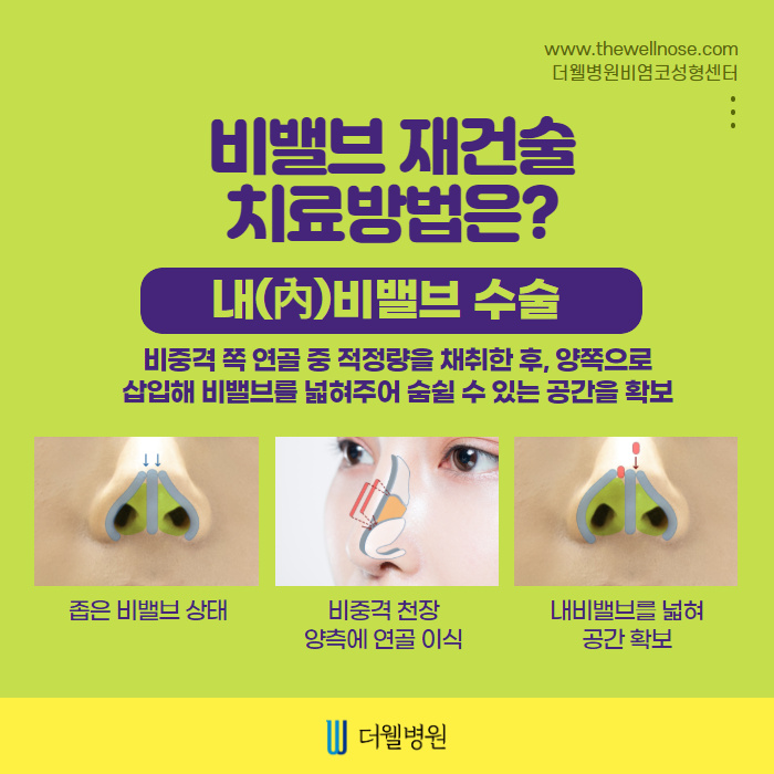 ce1284fc088b2abcacb9dca766c46b9e_1698891945_6165.jpg 더웰병원 ce1284fc088b2abcacb9dca766c46b9e_1698891945_6165