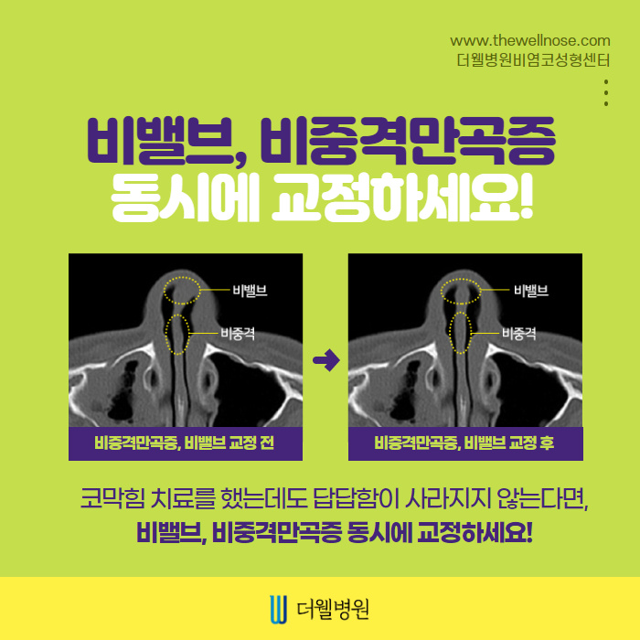 ce1284fc088b2abcacb9dca766c46b9e_1698891945_8853.jpg 더웰병원 ce1284fc088b2abcacb9dca766c46b9e_1698891945_8853
