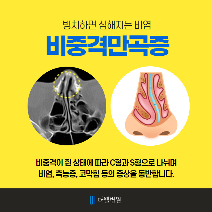 더웰병원 ce1284fc088b2abcacb9dca766c46b9e_1698891968_5631