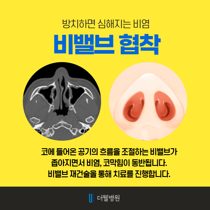 더웰병원 ce1284fc088b2abcacb9dca766c46b9e_1698891968_6812