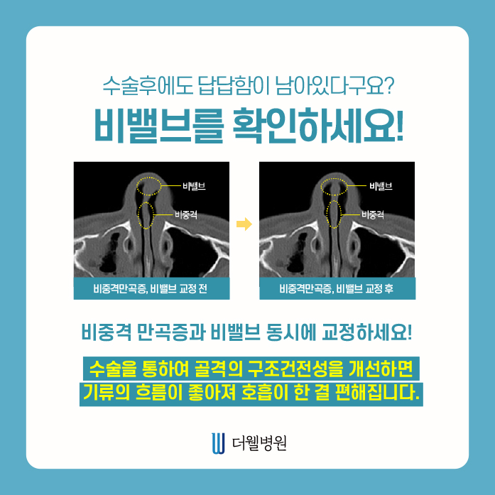 ce1284fc088b2abcacb9dca766c46b9e_1698891993_9549.jpg 더웰병원 ce1284fc088b2abcacb9dca766c46b9e_1698891993_9549