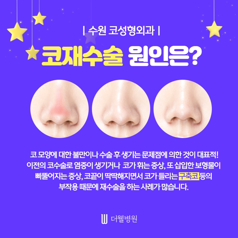 ce1284fc088b2abcacb9dca766c46b9e_1698892183_9377.jpg 더웰병원 ce1284fc088b2abcacb9dca766c46b9e_1698892183_9377