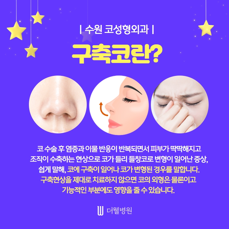ce1284fc088b2abcacb9dca766c46b9e_1698892184_1261.jpg 더웰병원 ce1284fc088b2abcacb9dca766c46b9e_1698892184_1261