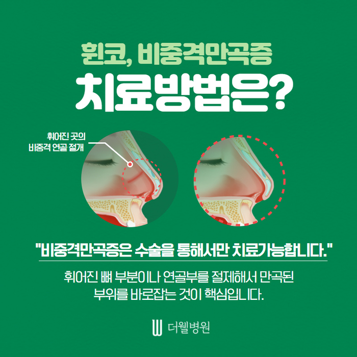 더웰병원 ce1284fc088b2abcacb9dca766c46b9e_1698892310_708