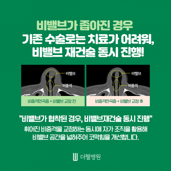 더웰병원 ce1284fc088b2abcacb9dca766c46b9e_1698892311_0315