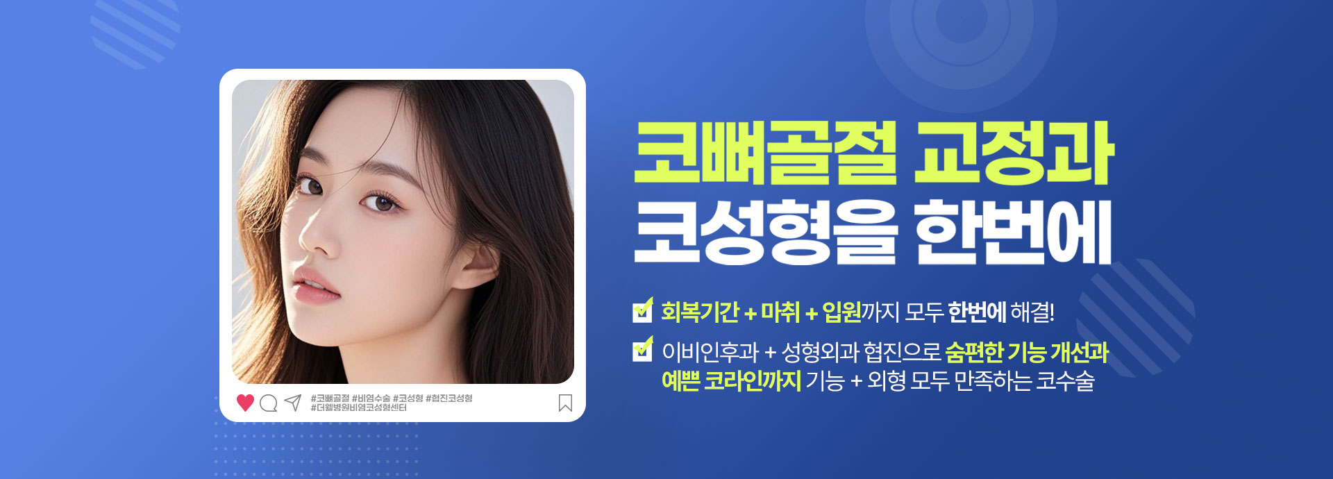 코뼈골절 교정과 코성형을 한번에