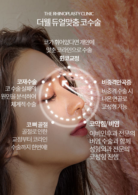 더웰병원 비밸브재건술, 비밸브, 비밸브협착증, 비염, 코질환, 코수술, 코성형 더웰병원