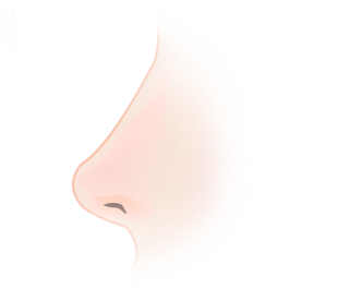 더웰병원 비중격만곡증의 치료
