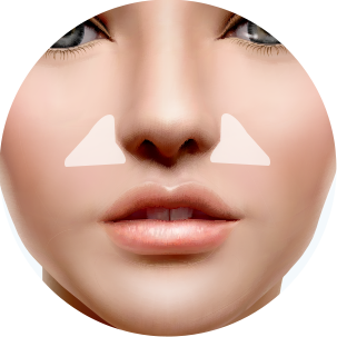 더웰병원 귀족 수술