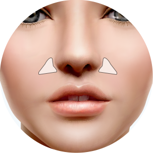 더웰병원 귀족 수술