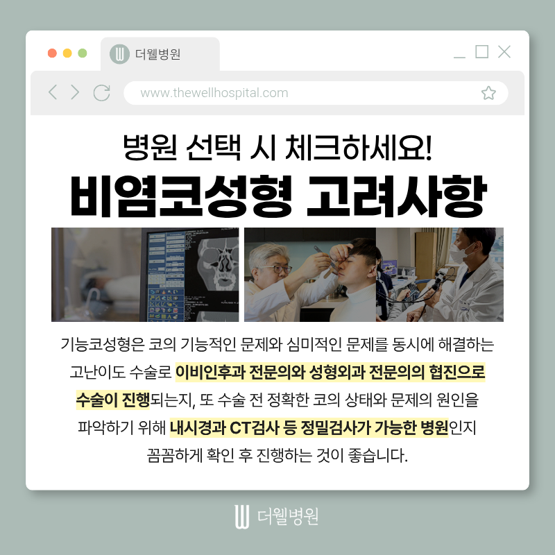 수원더웰병원, 비염코성형, 코막힘코성형