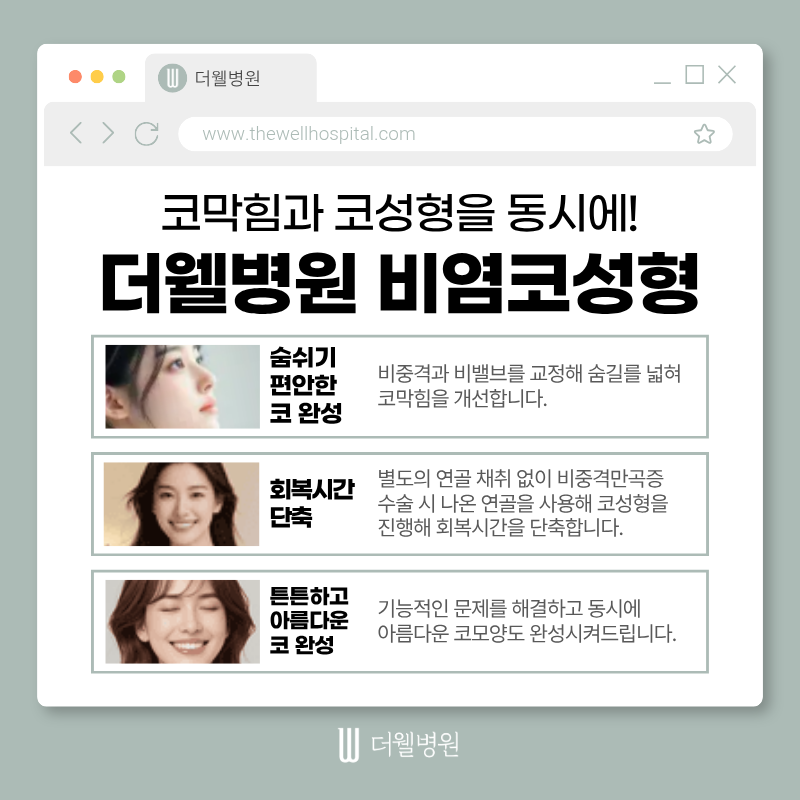 수원더웰병원, 비염코성형, 코막힘코성형