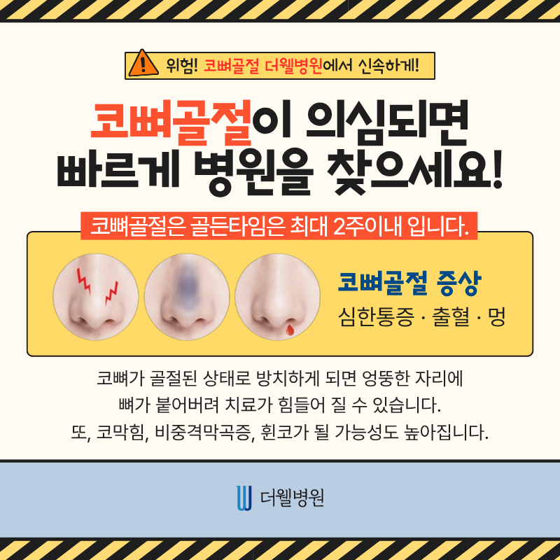 코뼈골절성형외과, 코뼈골절병원, 코뼈골절수술