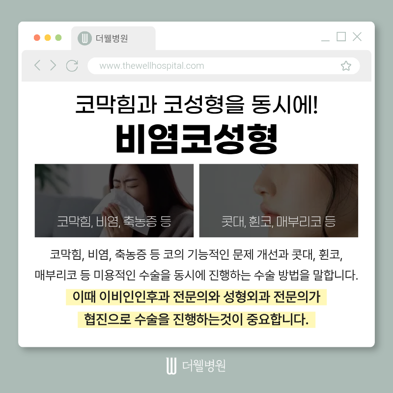 수원더웰병원, 비염코성형, 코막힘코성형