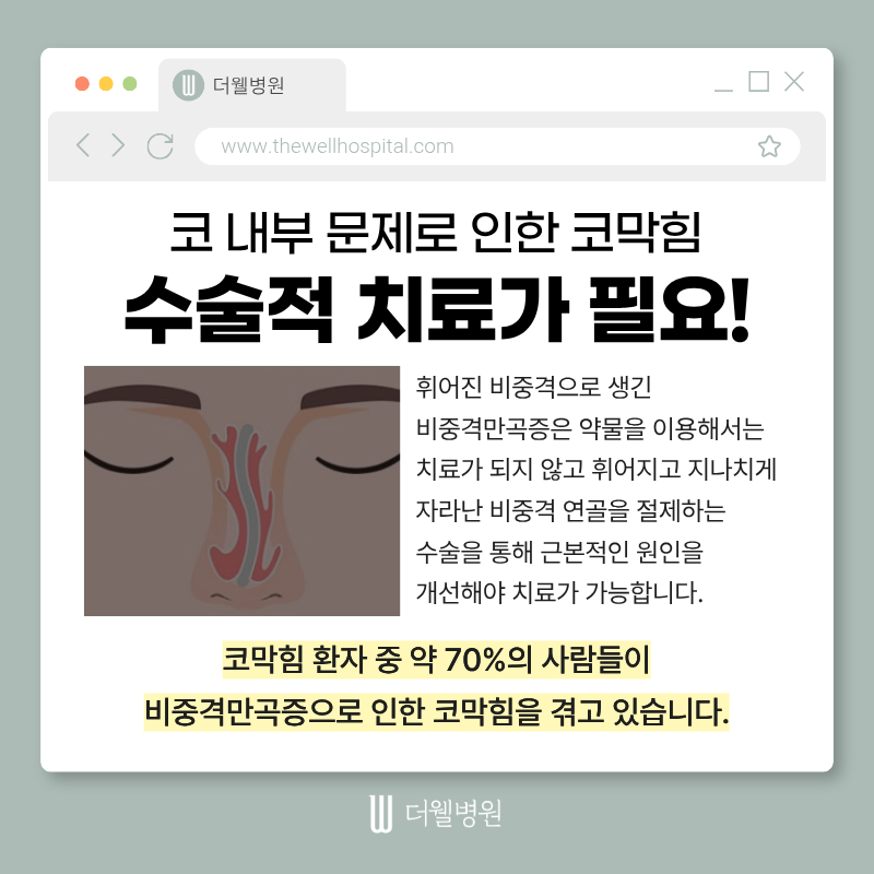 수원더웰병원, 비염코성형, 코막힘코성형