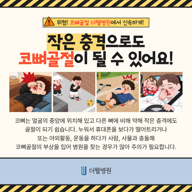 코뼈골절성형외과, 코뼈골절병원, 코뼈골절수술
